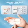 LitBear Large Acne Pimple Patches, 6 Sizes 100 Patches for Large Breakouts, Acne Patches for Face, Chin or Body, Acne Spot Patch with Tea Tree & Calendula Oil, Hydrocolloid Bandages for Acne Skin view 2