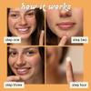 LeSpot Pimple Patches for Face  Effective & Invisible Hydrocolloid Acne Patches for Covering Zits & Blemishes, Zit Patches for Face That Stay in Place, Korean Pimple Patches, 38 Count view 3