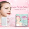 NinthAvenue Basics Skin Treatment Mask for Acne - Cleansing view 4