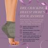Ballotte Moisturizing Heel Socks for Dry Cracked Feet Women, Gel-Lined Heel Socks, Refreshing Foot Sleeve for Cracked Footbed, Hydrating Feet Guards for Women Overnight Repair (2 Pairs, Gray) view 3