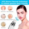 Blackhead Remover Pore Vacuum,Upgraded Facial Pore Cleaner,Electric Acne Comedone Whitehead Extractor Tool-5 Suction Power,5 Probes,USB Rechargeable view 4