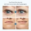 OIA Anti Wrinkle Patches 2.0 Eyes & Smile | Smile Lines & Eyes Wrinkles | Made with 100% Medical Grade Silicon | Advanced Wrinkle Care with Clear Reusable Pads | Overnight Wrinkle Smoothing view 3