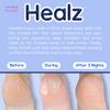 Healz Hydrocolloid Patches for Dry and Cracked Heels (20 Count) view 3