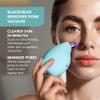 FOREO KIWI Whitehead & Black Head Remover for Face - Facial Skin Care Tools - Blackhead Extractor for Face & Nose - No Pore Strips Suction - Quick & Effective Blackhead Remover Device view 2