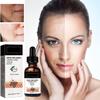 Advanced Melanclear Facial Serum,CC Advanced MelanClear Facial Serum,Melanin Correcting Facial Serum, Dark Spot Corrector Daily Face Serum, Melanin Correcting Facial (3pcs) view 2