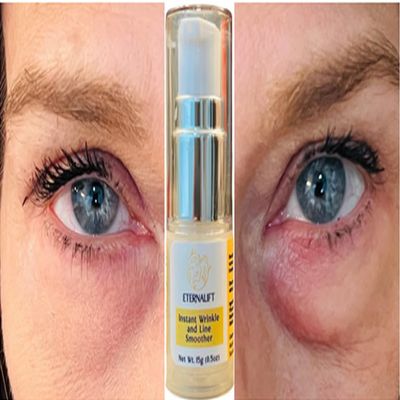 Instant Eye Bag Puffiness And Wrinkle Remover Cream For Women And Men Made In The USA! Cruelty-Free Larger Size
