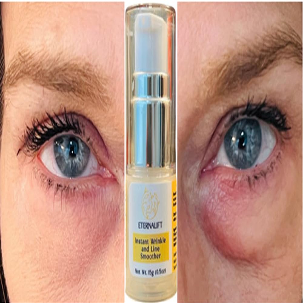 Instant Eye Bag Puffiness And Wrinkle Remover Cream For Women And Men Made In The USA! Cruelty-Free Larger Size