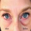Instant Eye Bag Puffiness And Wrinkle Remover Cream For Women And Men Made In The USA! Cruelty-Free Larger Size view 2