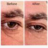 Instant Eye Bag Puffiness And Wrinkle Remover Cream For Women And Men Made In The USA! Cruelty-Free Larger Size view 3