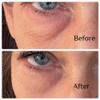 Instant Eye Bag Puffiness And Wrinkle Remover Cream For Women And Men Made In The USA! Cruelty-Free Larger Size view 4