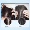 Bablabear Scalp Exfoliator Scrub,Itchy Scalp Treatment for Dandruff, No Sulfate Hair Scrub To Soothe a Dry, Flaky,Scalp,Removes Buildup,Clarifying Shampoo. view 3