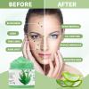 Aloe Vera Facial Scrub & Cleanser - Exfoliating Face Wash for Blackheads & Acne view 2