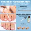 Ingrown Toenail Treatment w/Ingrown Toenail Drops Reliever & Softener,Double Sided Pedicure Nail Lifter Tool for Easy Trimming Care Thick Nail & Ingrown Toe Nail,Toenail Cleaner Kit for Men Women view 2