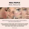 Nudestix Lemon-Aid Detox & Glow Micro-Peel  3-in-1 Enzyme Face Exfoliator with AHAs, Vitamin C & Fruit Extracts for Bright, Smooth Skin | Clean, Vegan, Pore Detoxifying Peel view 3