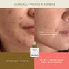 EADEM Milk Marvel Dark Spot Serum, Vitamin C Face Serum Infused with Niacinamide, Dark Spot Remover for Face and Body, Natural Dark Spot Corrector for Skin Care, 1 oz view 3