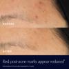 Este Lauder Advanced Night Repair Rescue Solution with 15% Bifidus Ferment to Reduce Visible Redness, 0.68 Fl Oz view 4