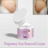 PEEZONS Pregnancy Scars Pemoval Stretch Mark Cream For All Skin Types - 50 GM (Pack Of 2) view 3