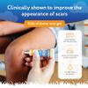 ScarAway Kids Silicone Scar Gel, 100% Medical-Grade, Helps Improve Size, Color & Texture of Hypertrophic & Keloid Scars on Face & Body from Injury, Burns & Surgery, Water Resistant, Clear, 6g view 2
