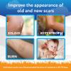 ScarAway Kids Silicone Scar Gel, 100% Medical-Grade, Helps Improve Size, Color & Texture of Hypertrophic & Keloid Scars on Face & Body from Injury, Burns & Surgery, Water Resistant, Clear, 6g view 3