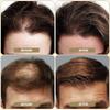 SOVONCARE Hair Fibers for Thinning Hair Medium Blonde, Hair Building Fibers for Bald Spots Undetectable & Natural Conceals Hair Loss Fill In Fine Hair Powder Hair Thicker Instantly for Women & Men 28g view 3