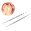 Ingrown Toenail Tool Kit, Professional Toenail File, Stainless Steel Ingrown Toenail File Lifter Set Pedicure Tool, Nail Cleaner Tools, Manicure Pedicure for Ingrown Under Nail Cleaner view 2