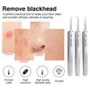 3Pcs Blackhead Tweezer Professional Facial Blackhead Remover Tweezers Precision Extractor Acne Removal Kit Pimple Popper Tool for Whitehead Blemishs Comedones view 2