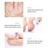 Electric Foot Callus Remover with Vacuum, Rechargeable Portable Foot Scrubber File Pedicure Kits for Cracked Heels Dead Skin view 2