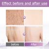 Bump Eraser Body Scrub Exfoliant for Keratosis Pilaris Body Acne Dead Skin Ingrown Hair Razor Bumps and Rough Patches Keratosis Pilaris Treatment Strawberry Legs Treatment for Women view 4