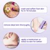 4 Pcs Foot Pumice Stone and Scrubber for Feet and Heels Callus and Dead Skins (Purple) view 4
