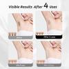 Laser Hair Removal Device for Women and Men, IPL Painless Sapphire Laser Hair with 40F Ice-Cooling System, Safe for Body Treatment, Long-Lasting Hair Removal from Home, Face, Legs, Back Bikini Line view 4