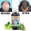 BlueQueen Herbal Hair Oil - Nourishing with Amla & Bhringraj for Reduced Hair Fall, Strengthened Roots, and Enhanced Hair Growth - 100ml view 4