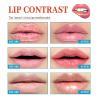 Dry Cracked Lips - Natural Healing Lip Balm, Organic All-Day Moisture Cheilitis Treatment Cream - Men, Women & Children, Dermatologist Recommended view 4