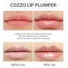 AKAZIC Alicroplct Vitamin E Lip Serum, Natural Lip Plumper & Lip Treatment Serum, Lip Plumper Serum Instant Lip Filler, Eliminates Dry Wrinkles Plumping Gloss. view 2