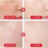 AKAZIC Makeup Mist Moisturizing Dual Phase Setting Mist, Hydrating Moisturizing Setting Mist, Suitable for All Skin Types view 2