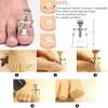 12pcs Stainless Steel Ingrown Toenail Tools Kit, Nail Treatment Pedicure Tools Toenail Clippers Tool Set view 4
