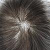 Healthlif Men's Toupee - Super Thin Skin, V-Looped Hair System, Poly Remy Human Hair, 8x10, 90% Density, #320#3 Dark Brown + 20% Grey view 4