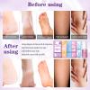 nbc BeautiLab Pedicure Foot Soak Set - Upgraded 6 in 1 Foot Spa, Foot Bath Spa, Pedicure Kit for Tired & Dry Cracked Feet, Athletes Feet, Bad Odor, Softens Calluses (3 Set Lavender) view 4