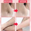 Cooling Gel for Hair Removal,Facial Gel Clear Coupling and Cooling Gel Use with Laser Hair Removal Device and Facial Body Skin Care Machine for Women & Men view 3