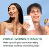 YOUR Improving Acne Patches: Ultra-thin Hydrocolloid Pimple Patch for Face; Purifies & Alleviates Stubborn Blemishes, Promotes Healing, Effective Zit Treatment. Made in USA. 56 Count view 4