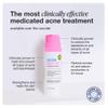 INNBEAUTY Project Acne Serum Medicated Treatment for Breakouts, Blackheads & Oil Control, 1 OZ (30ml) view 2