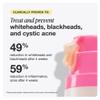 INNBEAUTY Project Acne Serum Medicated Treatment for Breakouts, Blackheads & Oil Control, 1 OZ (30ml) view 3