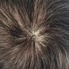 Hair Replacement System - All Poly Skin Toupee With 0.10mm Injected PU for Men, 8X10" 110% Density Natural Black #1B view 4