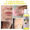 Yellow Peeling Oil for Dark Skin - Extra Strength Exfoliating Solution for Body, Strawberry Legs Treatment, Rough Bumpy Body Cream, Skin Remover for Women view 2