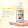 Yellow Peeling Oil for Dark Skin - Extra Strength Exfoliating Solution for Body, Strawberry Legs Treatment, Rough Bumpy Body Cream, Skin Remover for Women view 4