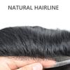 F M FACE MIRACLE NEW YORK Toupee For Men Soft French Lace Hairpiece Durable Clear Poly Around Hair System Replacement Mens Toupee Human Hair Prosthesis For Men 6"X9"#1B Off Black-120% density view 3