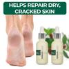 nu119 How to Get Soft Feet | Foot Care Kit Includes 120ml Instant Foot Peel Spray for Calluses Removal, Softening Balm & File | Professional Products to Make Your Feet Soft view 4