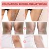 Abera Underarm Dark Spot Corrector Cream with Bearberry Extract, Targeted Armpit Spot Reducer & Sensitive Area Skin Tone Enhancer, Natural Even Tone Solution with Arbutin & Niacinamide view 3