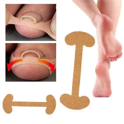 Ingrown Toenail Treatment, Cotton Ingrown Toenail Corrector Strips Toenail Straightener Easy to Use for Ingrown Nail
