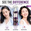 Award-WinningRevitalizing Scalp & Face Mist for Thicker Hair & Radiant Skin - Antioxidant Lotion - High-Potency Waterless Formula with No Harsh Chemicals or Preservatives view 2