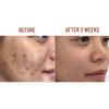 ABERA Nano Turmeric Vitamin C Serum, Nourish and Brighten Skin Tone, Reduce Dark Spots, Acne Bruise Relief, Restore Skin Strength, Skin Care Oil for Face (0.51 Fl Oz) (Set 2) view 3